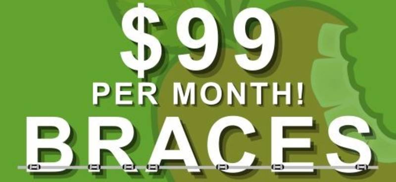 $99/mo Braces