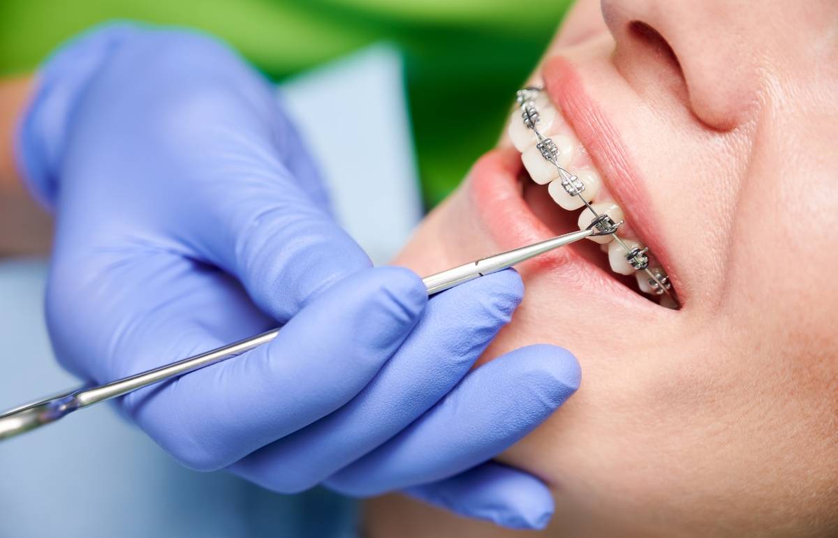Affordable Braces & Orthodontic Care | Apple Valley Dental & Braces